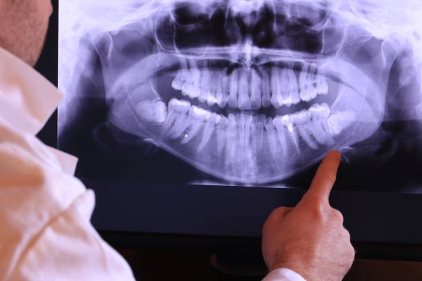 Best Emergency Cosmetic Dentistry (e.g., broken veneers) in Vienna, GA